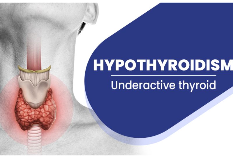 hypothyrodism