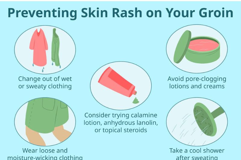 inner thigh rashes